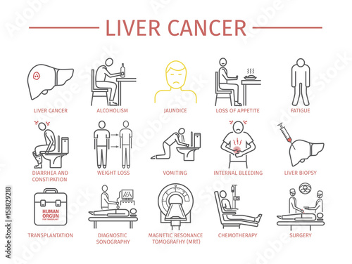 Liver Cencer Symptoms
