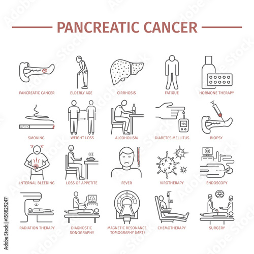 Pancreatic Pancreas Cancer Symptoms. Causes.
