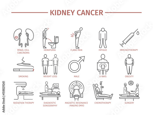 Kidney Cancer Symptoms.