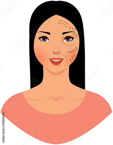 Beautiful asian woman with marks drawn on her face for plastic cosmetic surgery vector illustration