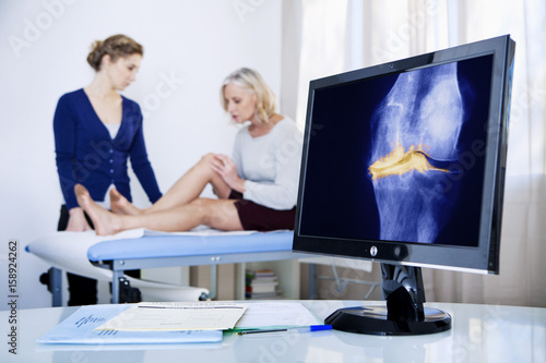 X-ray of a knee arthrosis