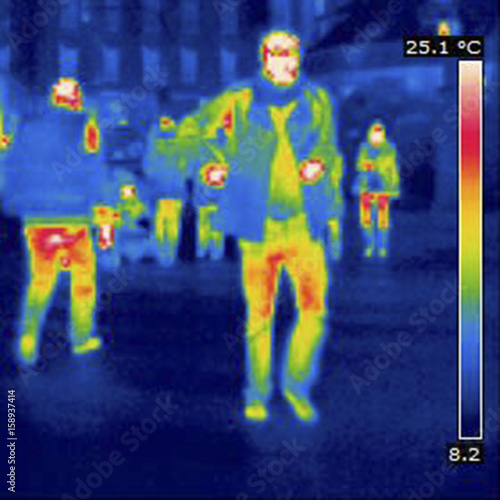 Thermogram photo