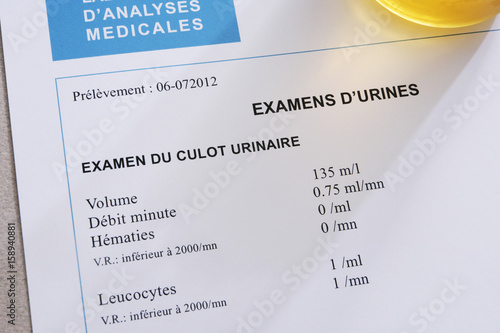 Cytobacterial examination of urines : research of cells (red blood corpuscles and leucocytes) in the urinary cap (after centrifugation of the urine) No pathology photo