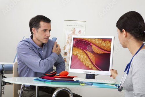 Models On screen, drawing representing an artery obstructed by a thrombus caused by a plaque of atheroma photo