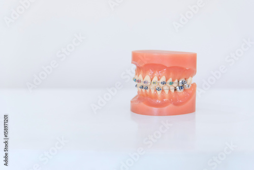 Artificial model of human jaw with wire colorful braces attached. Dental and orthodontic office presentation tool on white background and copy space. photo