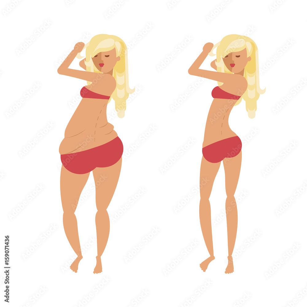 Body woman correction, cellulite fat, plastic surgery, women weight loss success, woman beauty. Concept for banner or flyer, abstract isolated vector eps10 illustration Body woman correction, cellulite fat, plastic surgery, women weight loss success, woman beauty. Concept for banner or flyer, abstract isolated vector eps10 illustration