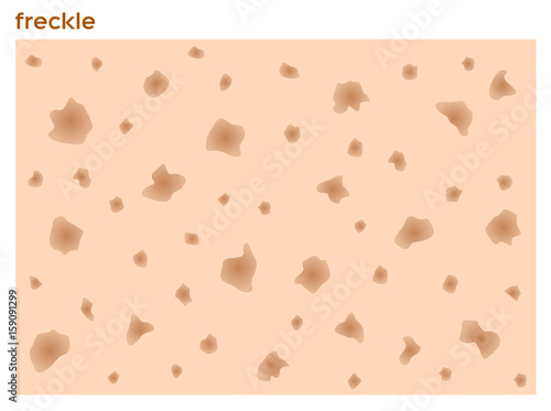 Canvas Print freckle skin texture graphic , vector , nice skin