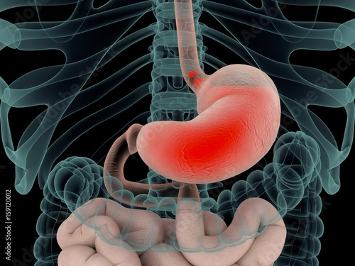 Acid reflux, GERD. Gastroesophageal reflux disease. Stomach and digestive. Human anatomy. 3d illustration photo