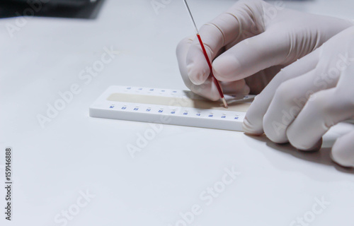 blood sample for hematocrit testing on white background