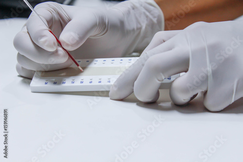 blood sample for hematocrit testing on white background