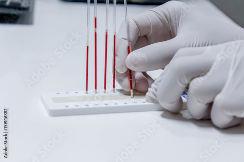 blood sample for hematocrit testing on white background