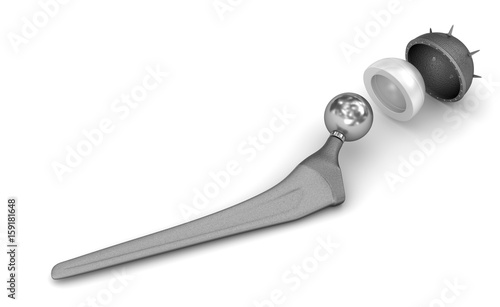 Hip replacement implant isolated on white. Medically accurate 3D illustration