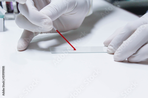 sample for blood smear method photo