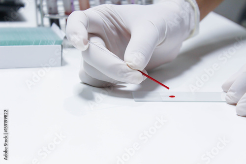sample for blood smear method
