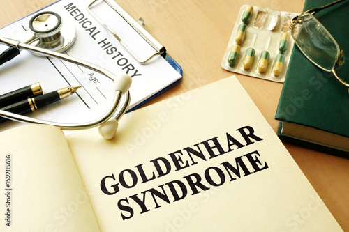 Book with title Goldenhar Syndrome on a table.