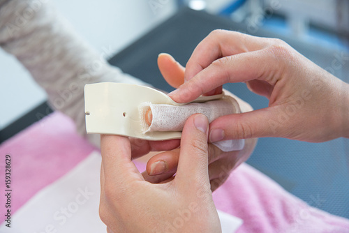 FINGER ORTHOSIS