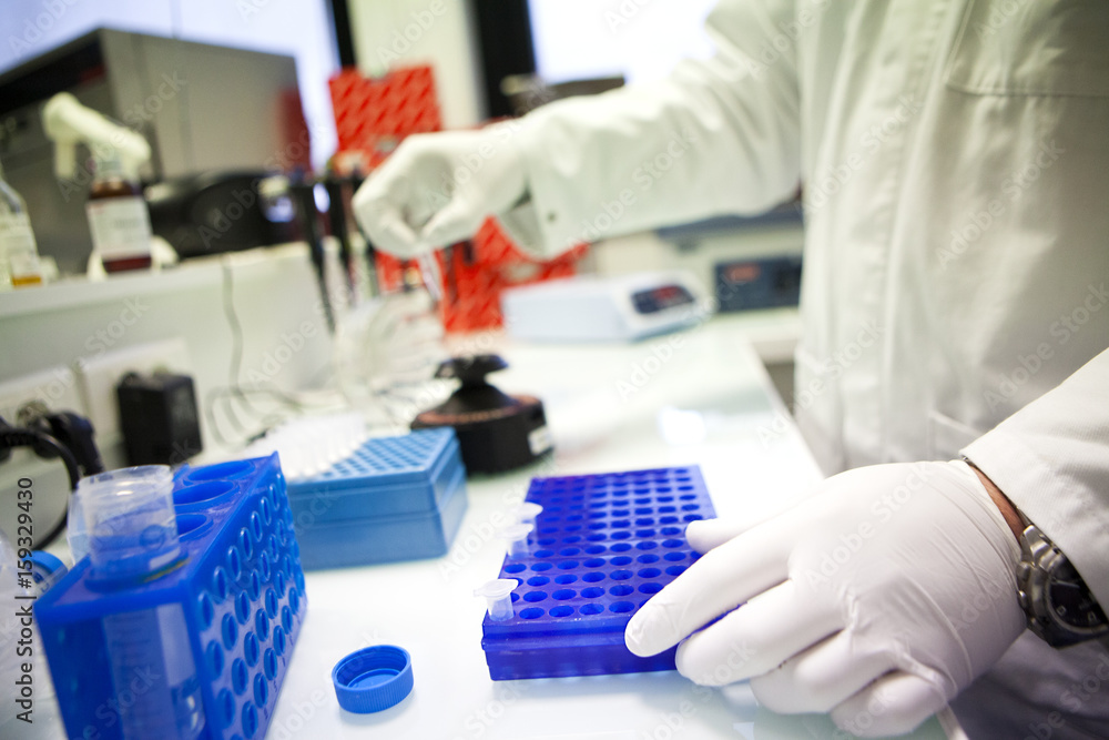 AIDS, RESEARCH AIDS, RESEARCH