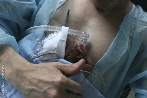 FATHER AND PREMATURE BABY photo