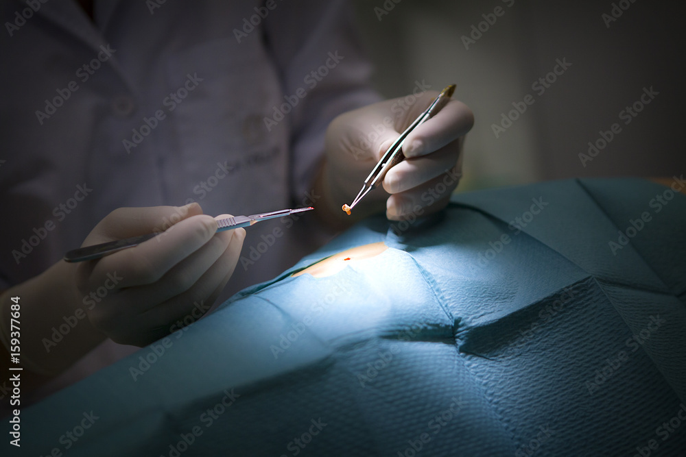 DERMATOLOGIC SURGERY Stock Photo Adobe Stock