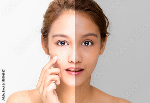 woman face with half sunburn and half sunscreen, beautiful girl of half latina and half asian