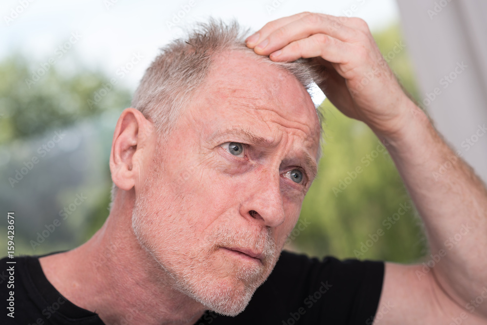 Obraz premium Senior man with hair concern