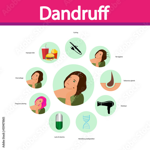 Reasons of dandruff. Vector. Cartoon character. Isolated. Flat