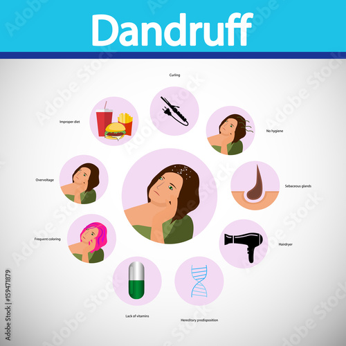 Reasons of dandruff. Vector. Cartoon character. Isolated. Flat