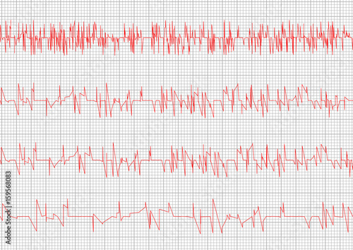 Red Heart cardiogram