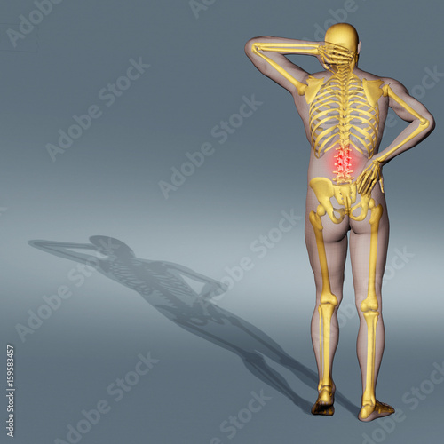 Computer-generated illustration of back pain photo