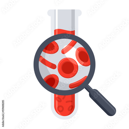 Hematology concept with red blood cell in test tube and magnifying glass, vector illustration in flat style