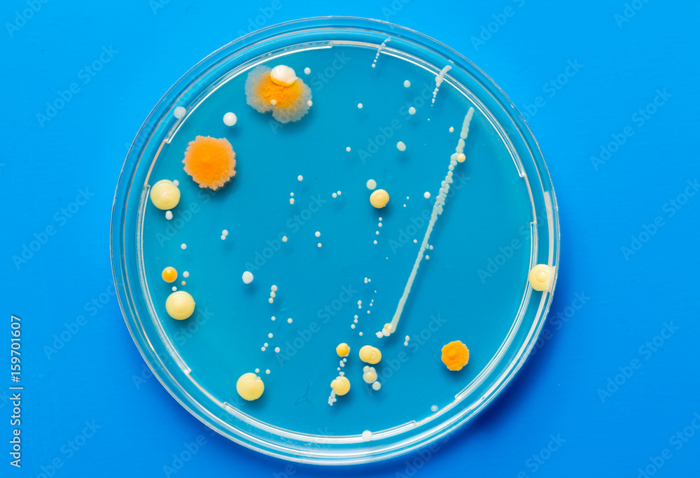 A petri dish with growing cultures of fungi and