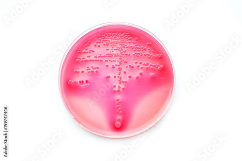Colonies of bacteria in petri dish 
