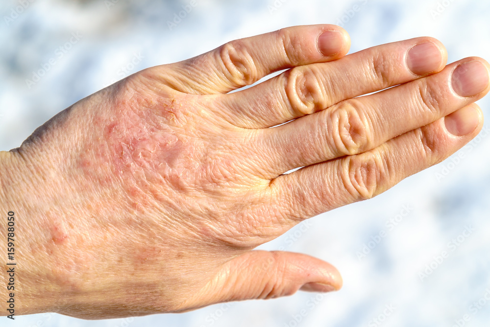 Fototapeta premium Detailed closeup of dry mature woman hand