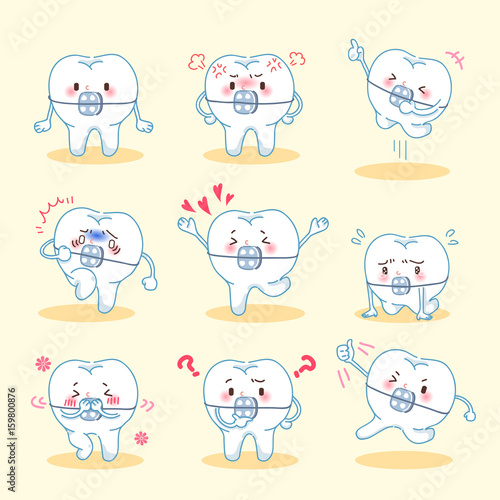 tooth wear brace do emotion
