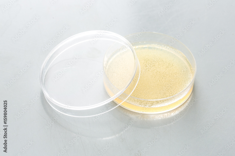Petri dish with bacterial culture in agar Petri dish with bacterial culture in agar