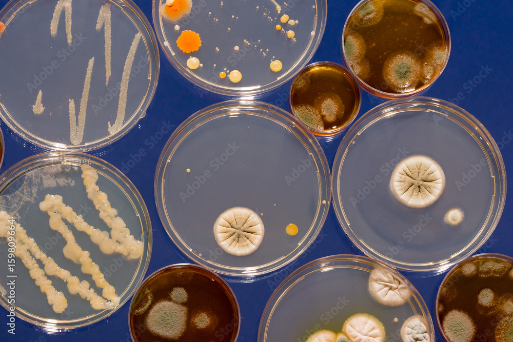 A petri dish with growing cultures of fungi and