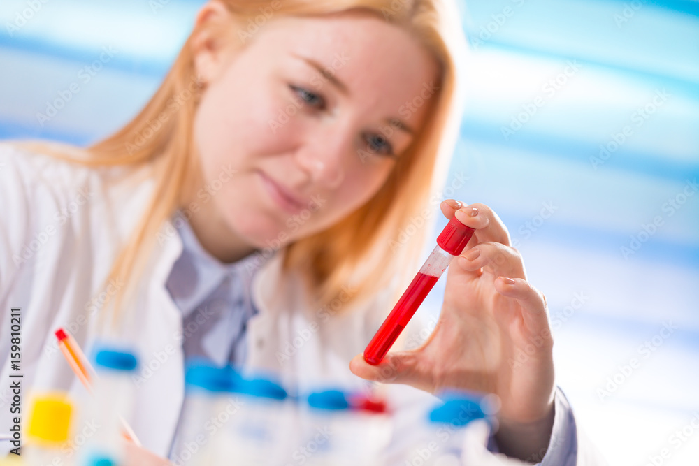 Female laboratory assistant with blood test for AIDS Female laboratory assistant with blood test for AIDS