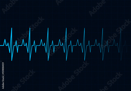 Heart beats cardiogram