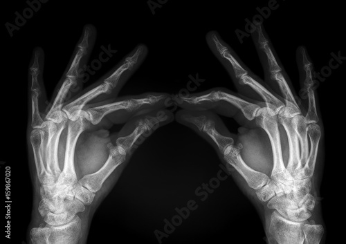 hands radiography photo