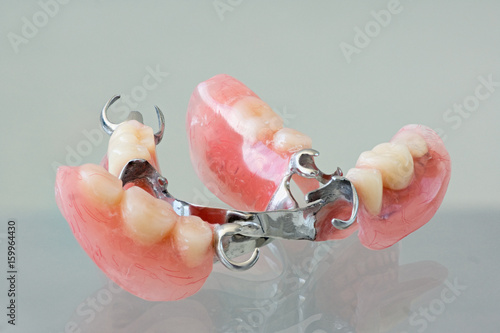 Clasp denture with a metal arc