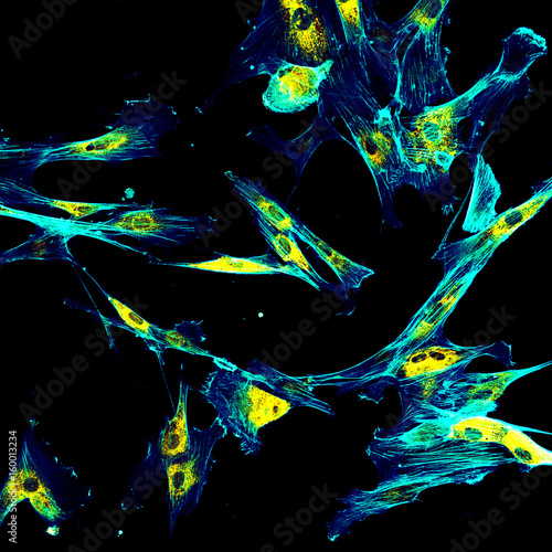 Immunofluorescence confocal imaging of fibroblasts with endoplasmic reticulum in yellow and cytoskeleton in cyan photo
