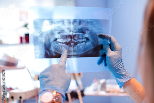 Close-up of female doctor pointing at teeth x-ray image at dental office. photo
