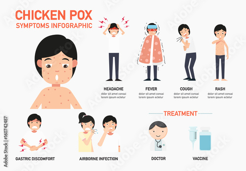 chicken pox symptoms infographic, illustration.