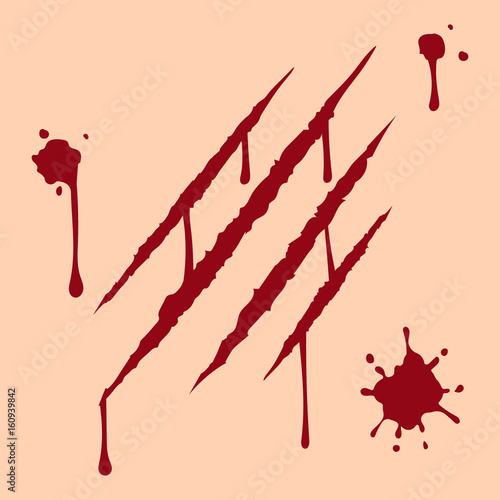 Illustration of claw scratch.