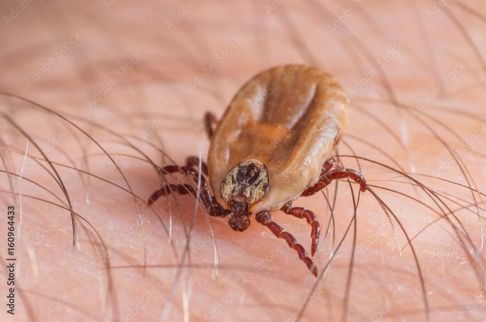 Mite crawls on human skin Mite crawls on human skin