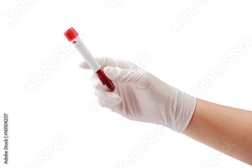 Hand holding test tube with blood plasma ready for testing on white clipping path.