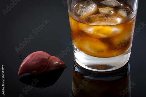 Alcoholic liver damage and cirrhosis concept with a liver next to a glass of alcohol. Cirrhosis is most commonly caused by alcoholism, hepatitis B or C or non-alcoholic fatty liver disease