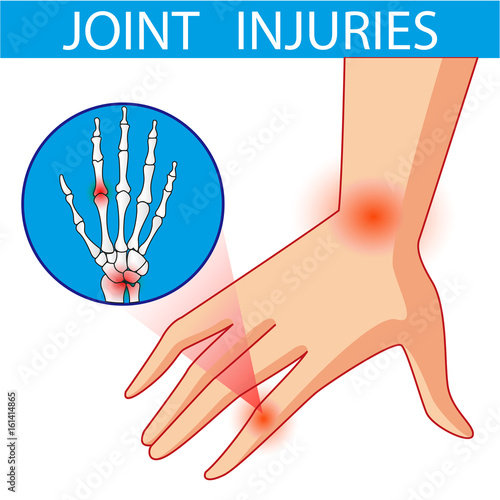 Joint pain. Cartoon vector illustration.