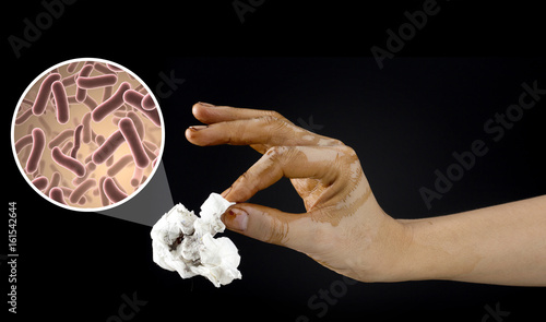 dirty hand with germs and bacteria