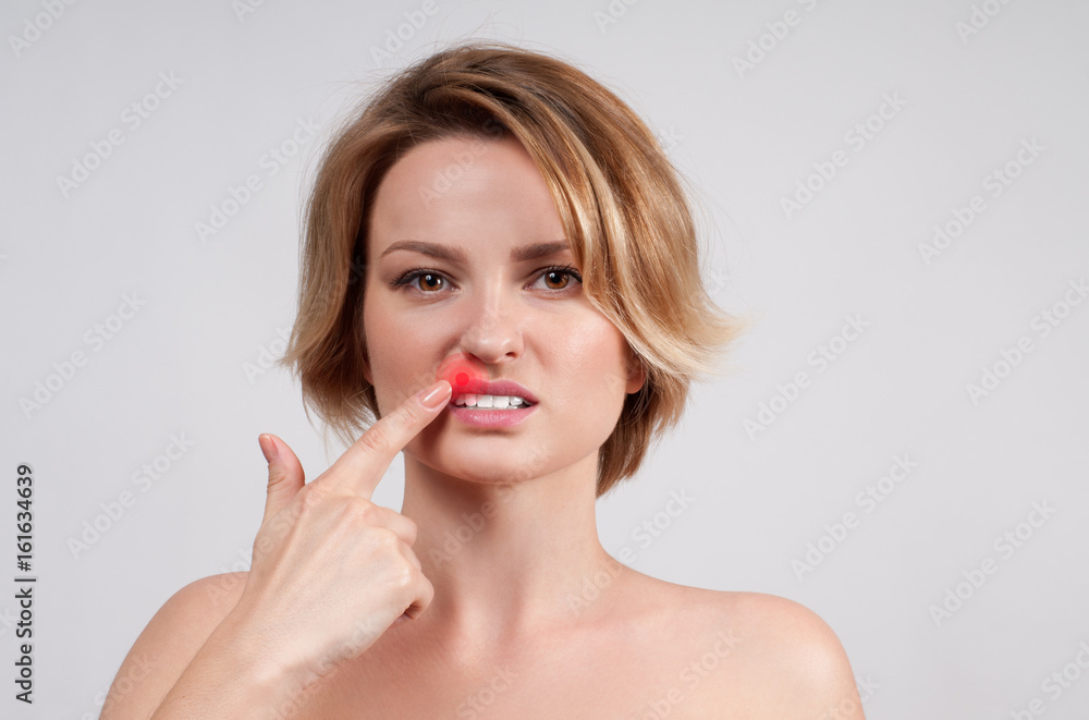 Close up of female lips affected by herpes virus Close up of female lips affected by herpes virus